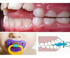 Top Information Why to Get Rid of the Dummy from Emergency Dentist in Banksia Grove