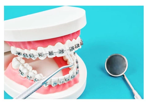 Get Perfect Alignment with Orthodontic Care