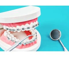 Get Perfect Alignment with Orthodontic Care
