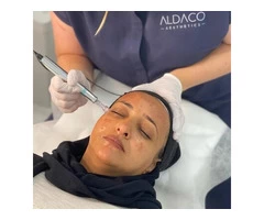 Skin Needling Melbourne