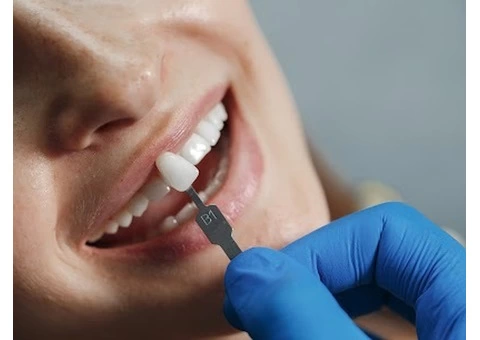 Quality Dental Crowns in Melbourne CBD