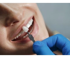 Quality Dental Crowns in Melbourne CBD