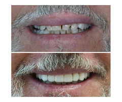 Kennedy Dental Cosmetics