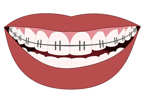 Best Dental Clinic in Highett - 3/3