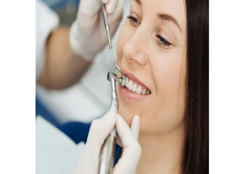 Experience Premier Lip Tie Release Treatment in Baulkham Hills