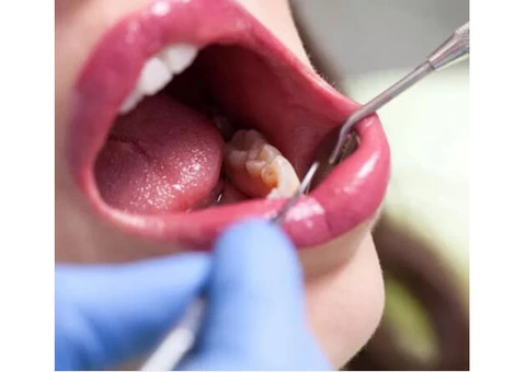 Get the Best General Dentistry Services from Emergency Dentist in Banksia Grove