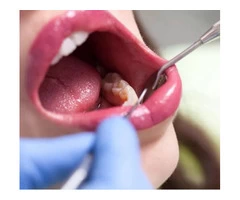 Get the Best General Dentistry Services from Emergency Dentist in Banksia Grove