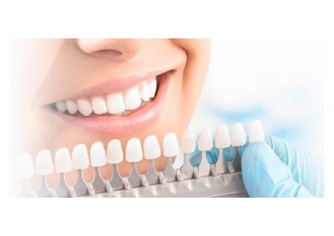 Trusted Blacktown Dentist - Your Smile Matters! - 1/4