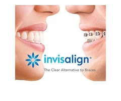 Invisalign Treatment Baulkham Hills