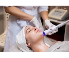 Ipl Treatment Melbourne