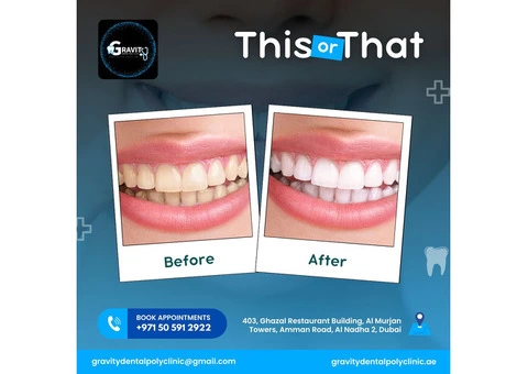 Gravity Dental Poly Clinic