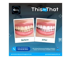 Gravity Dental Poly Clinic