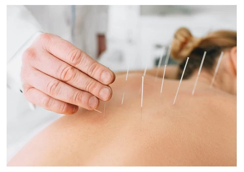 Best Remedial Massage Melbourne - Remedial   Massage Therapy - 5/10