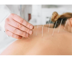 Get Pain Relief by Dry Needling - Best Massage Melbourne CBD