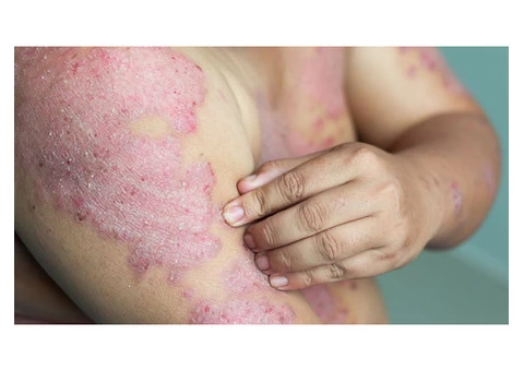 Skin Cancer Doctor near Me