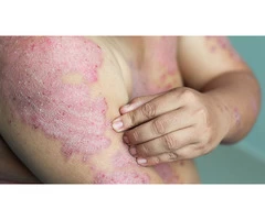 Skin Cancer Doctor near Me