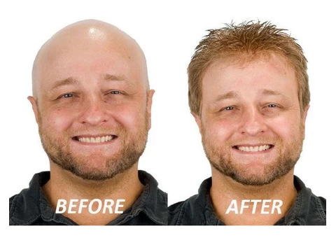 Choose the Best Hair Pieces for Men - 3/4