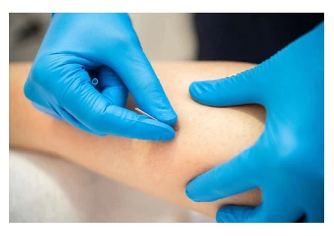 Dry Needling Adelaide