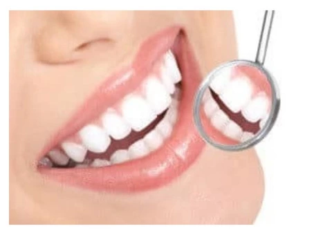Tooth Whitening Services at Emergency Dentist in Banksia Grove