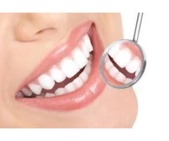 Tooth Whitening Services at Emergency Dentist in Banksia Grove
