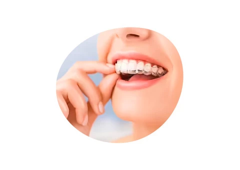 Chilldren Dentist Tarneit | Dental Clicnic | Wyndham Village Dental