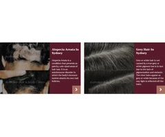 Advanced Hair Loss Treatments in Sydney at Australian Hair & Scalp Clinics