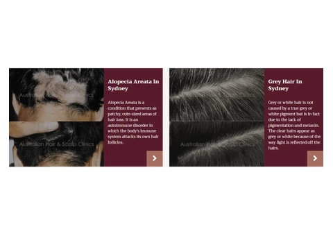 Advanced Hair Loss Treatments in Sydney at Australian Hair & Scalp Clinics