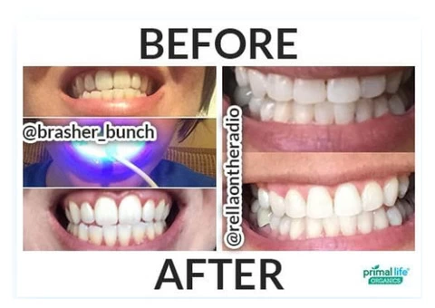 Whitens Teeth Up To 6 Shades In Less Than 16 Minutes.. - 8/8