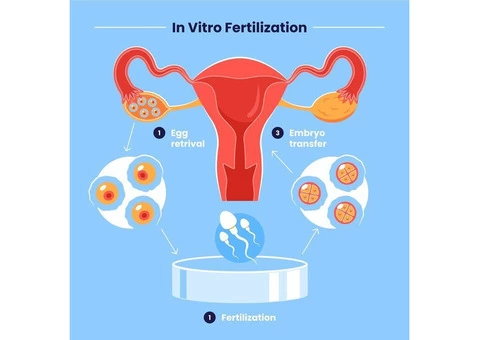 Australian Concept Infertility Medical Center