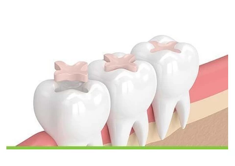 Trusted Emergency Dentist Epping - Serenity Smiles Dental - 3/4