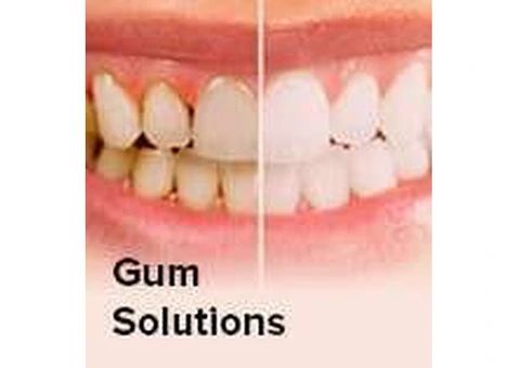 Unleash Your Radiant Smile Affordably at Sydney's Smile Concept! - 3/5