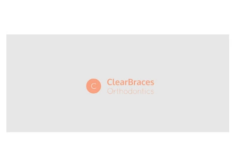 Your Trusted Smile with Best Braces at Clear Braces Orthodontics in Sydney! - 4/4