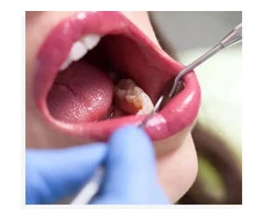 Premier Destination for Exceptional General Dentistry in Banksia Grove