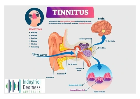 What Causes Tinnitus