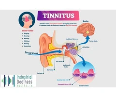 What Causes Tinnitus