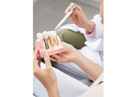 Elevate Your Smile With Unparalleled Expertise For Lasting Beauty - 2/3