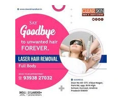 best laser treatment clinic in kurnool