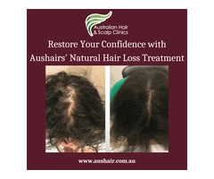 Restore Your Confidence with Aushairs' Natural Hair Loss Treatment