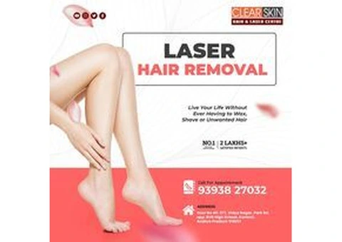 Laser treatment clinic in india