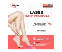 Laser treatment clinic in india
