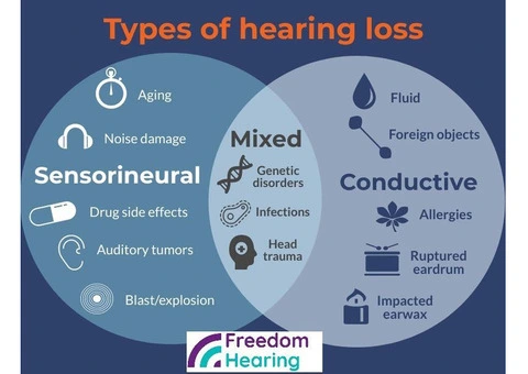 Types of hearing loss - 2/3