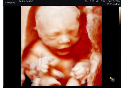 Experience Live 4D/5D Realistic VueScan with Exceptional Savings!