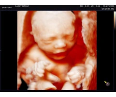 Experience Live 4D/5D Realistic VueScan with Exceptional Savings!