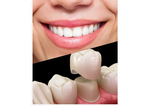 Discover Your Perfect Smile with Cosmetic Dentistry Services in Banksia Grove