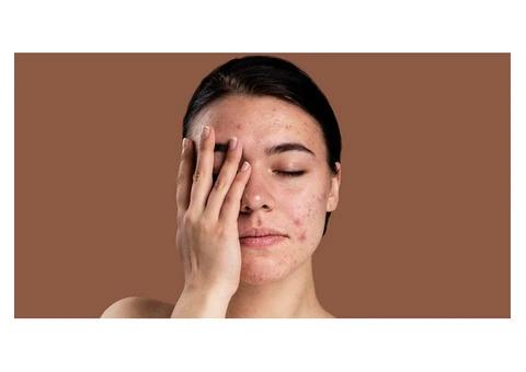 Learn the Impact of Aging on Skin Sensitivity from Skin Care Experts Australia