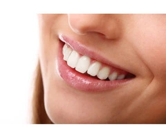 Professional Teeth Whitening in Box Hill