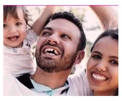 Teeth whitening adelaide