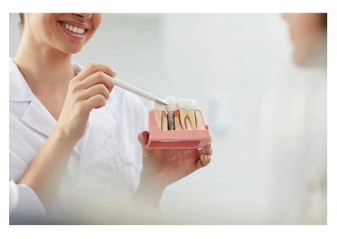 Best Tips for Choosing the Right Tooth Whitening Dentist in Richmond