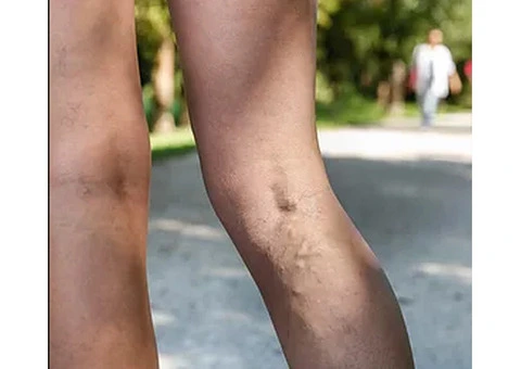 Dr Adrian Ling: Expert Vascular Surgeon in Melbourne - 2/2