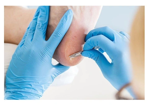 Call Bay Podiatry Clinic for Quick Remedies from Feet Problems